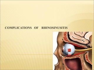 COMPLICATIONS OF RHINOSINUSITIS
 