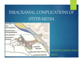 INRACRANIAL COMPLICATIONS OF
OTITIS MEDIA
DR.NEENA KARUNA KARAN
MMCH
 
