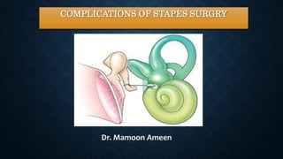 COMPLICATIONS OF STAPES SURGRY
Dr. Mamoon Ameen
 