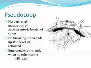 PseudoLoop
 Herbert, et al -
maturation of
antimesenteric border of
colon
 No Brooking, often ends
up skin level, or
retracted
 Emergencies only, only
when no other stoma
will reach
 