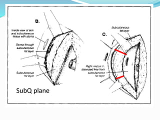 SubQ plane
 
