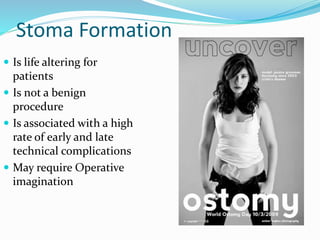Stoma Formation
 Is life altering for
patients
 Is not a benign
procedure
 Is associated with a high
rate of early and late
technical complications
 May require Operative
imagination
 