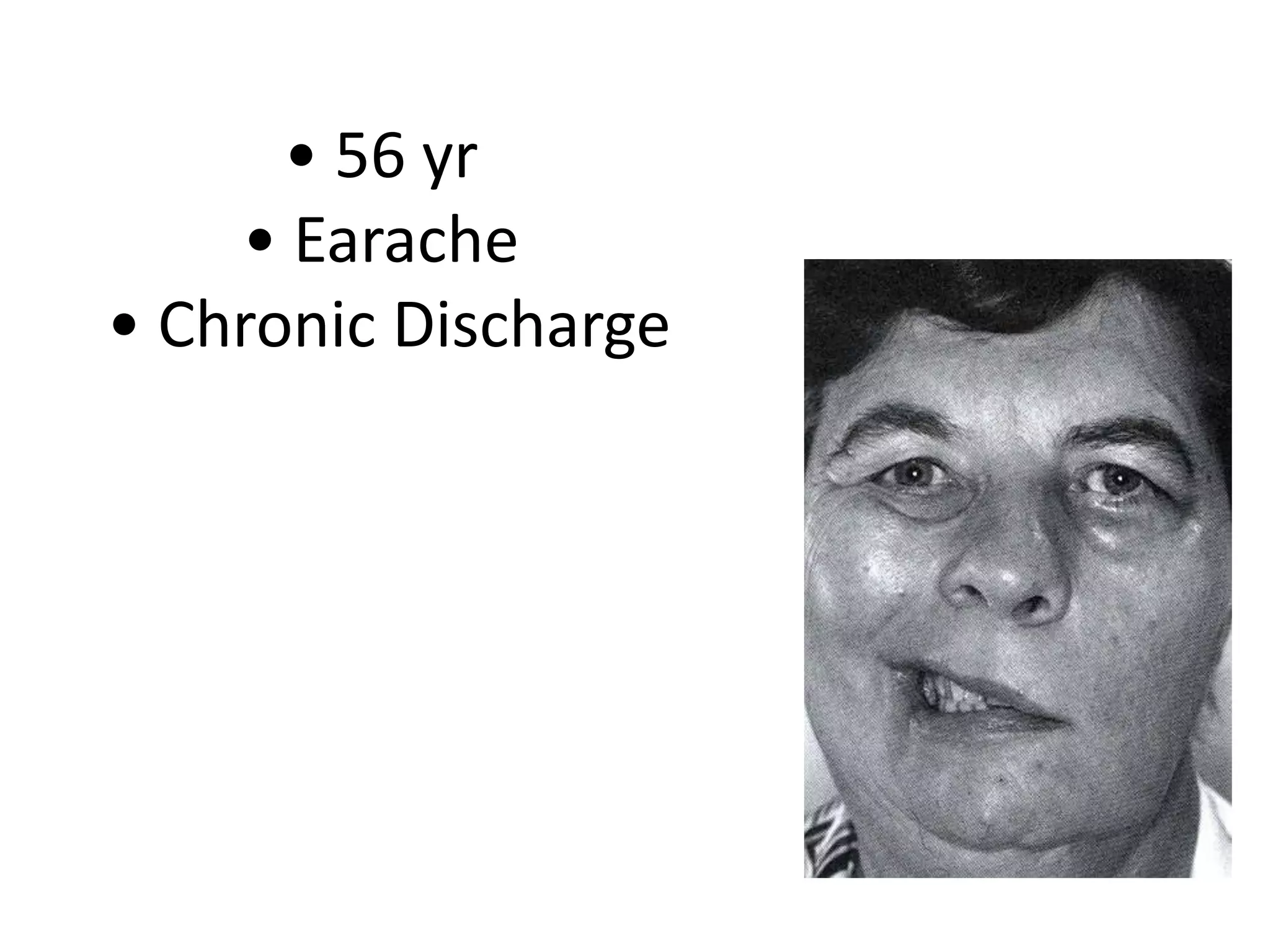 • 56 yr
    • Earache
• Chronic Discharge
 