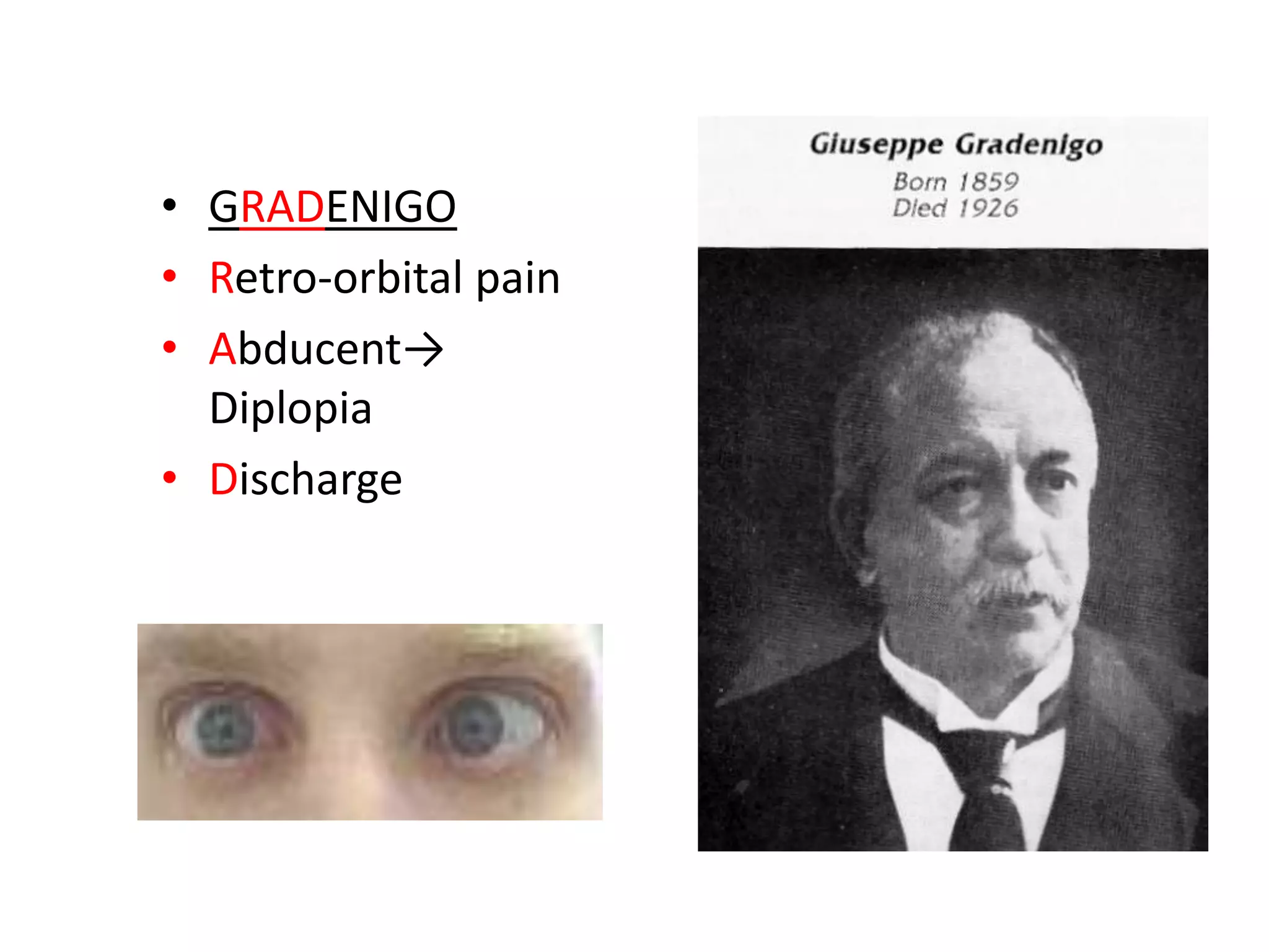 • GRADENIGO
• Retro-orbital pain
• Abducent→
  Diplopia
• Discharge
 