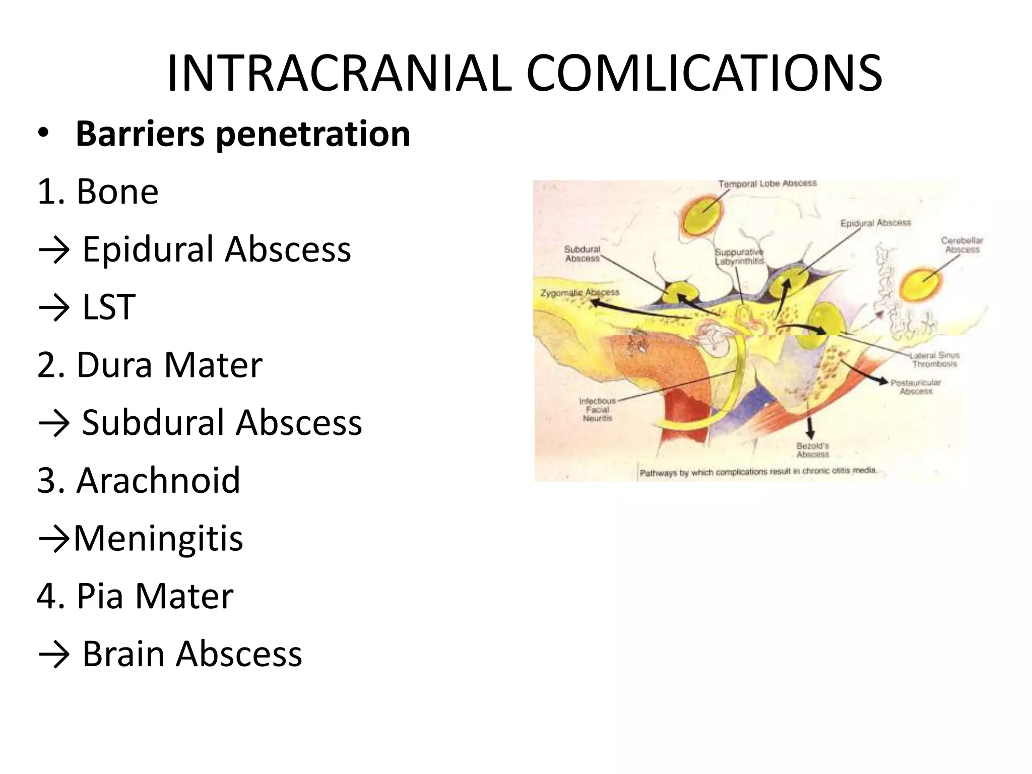 INTRACRANIAL COMLICATIONS
• Barriers penetration
1. Bone
→ Epidural Abscess
→ LST
2. Dura Mater
→ Subdural Abscess
3. Arachnoid
→Meningitis
4. Pia Mater
→ Brain Abscess
 