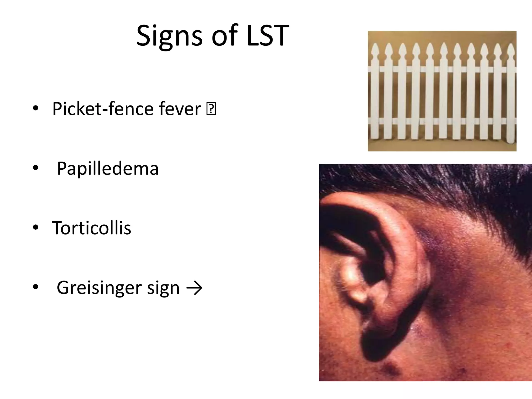 Signs of LST

• Picket-fence fever 􀃆

• Papilledema

• Torticollis

• Greisinger sign →
 
