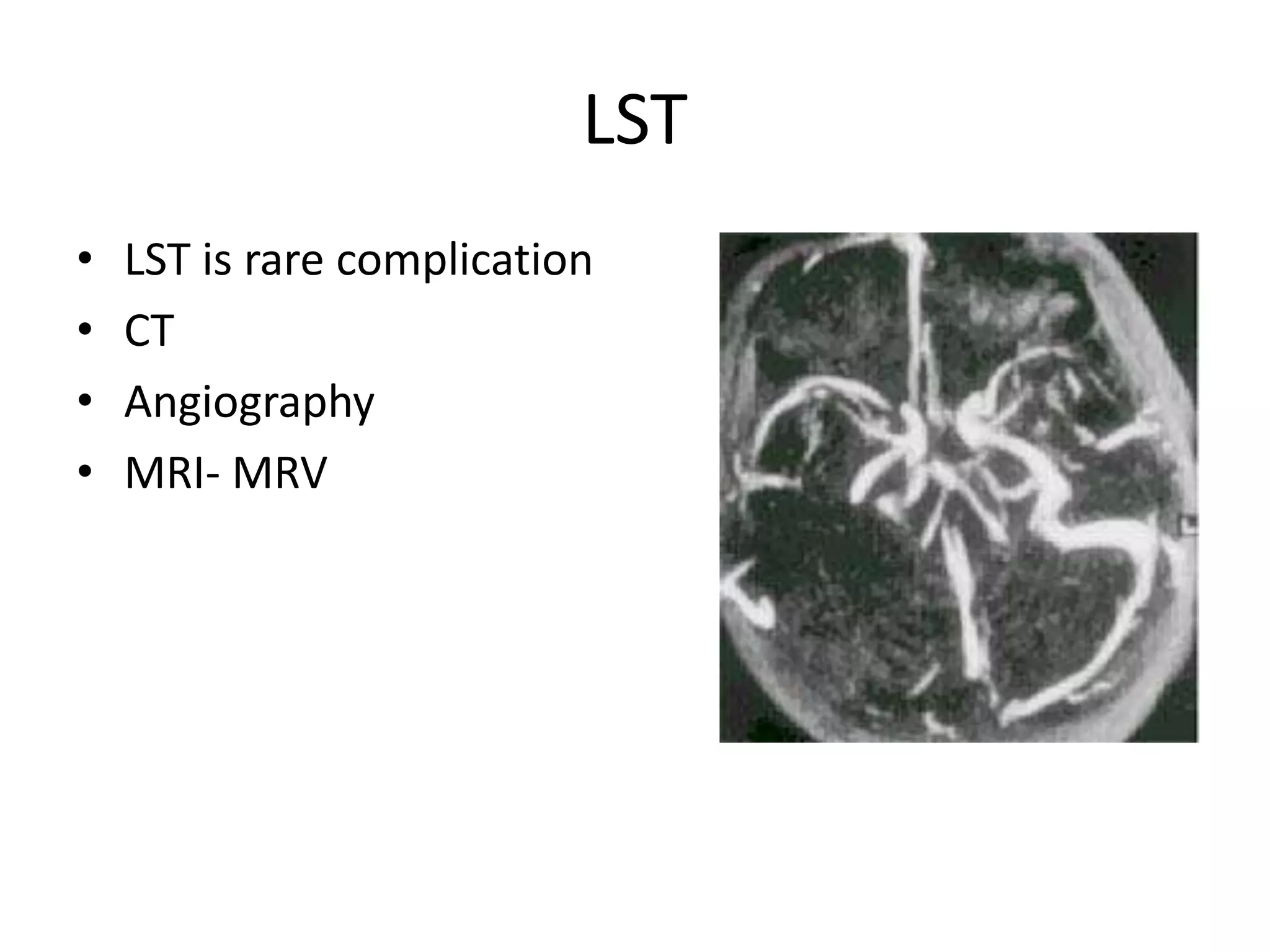 LST
•   LST is rare complication
•   CT
•   Angiography
•   MRI- MRV
 