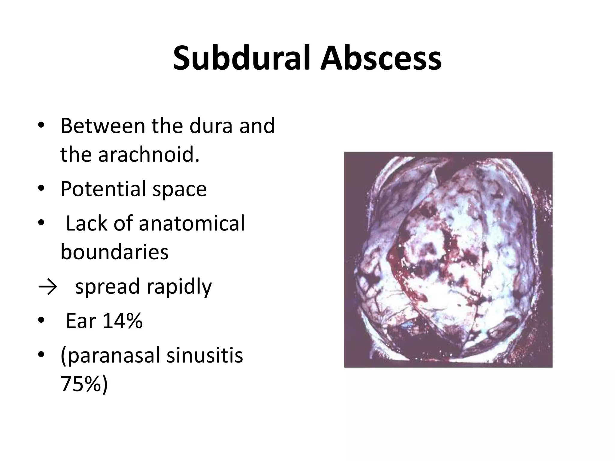 Subdural Abscess
• Between the dura and
  the arachnoid.
• Potential space
• Lack of anatomical
  boundaries
→ spread rapidly
• Ear 14%
• (paranasal sinusitis
  75%)
 