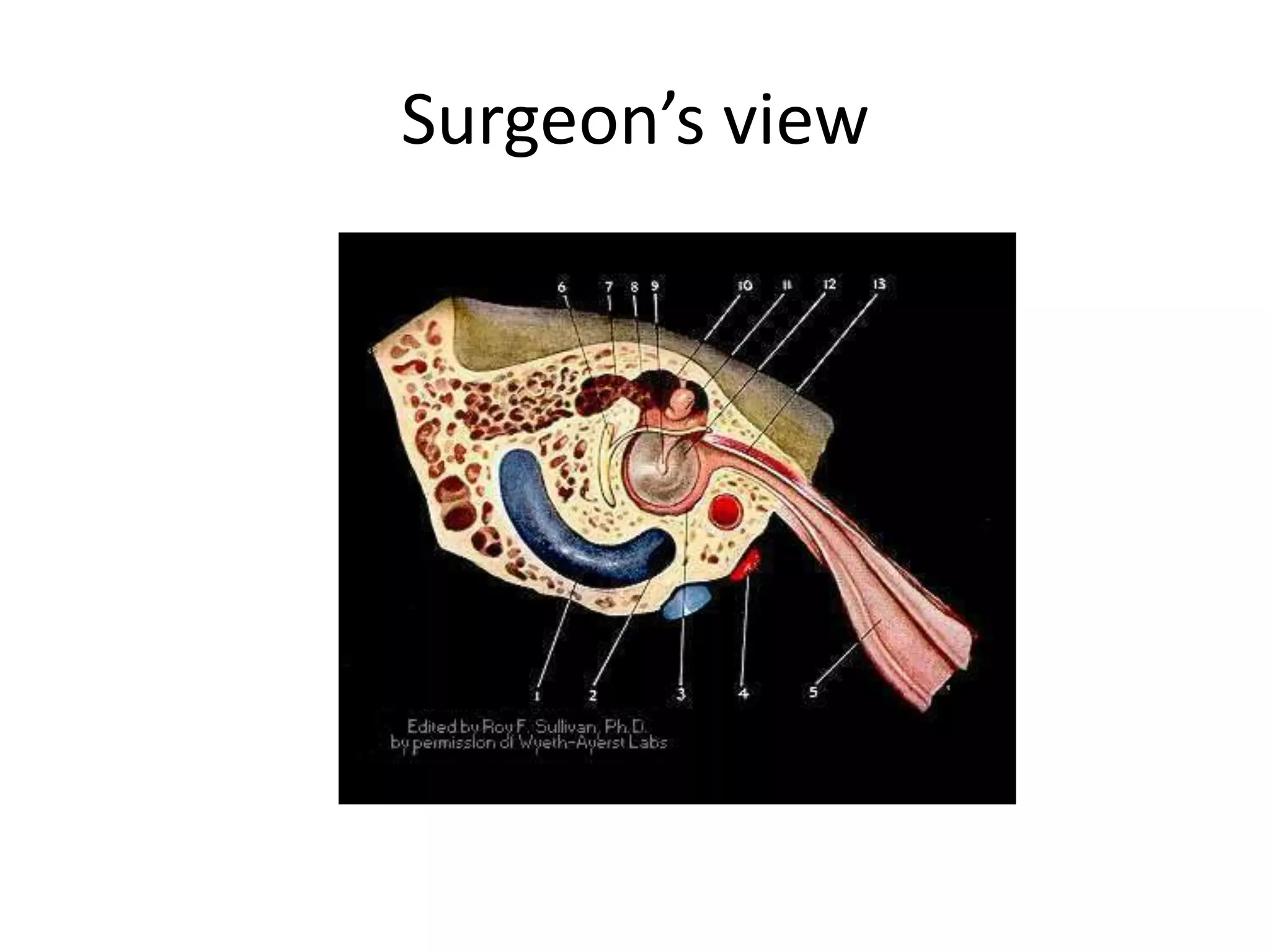 Surgeon’s view
 