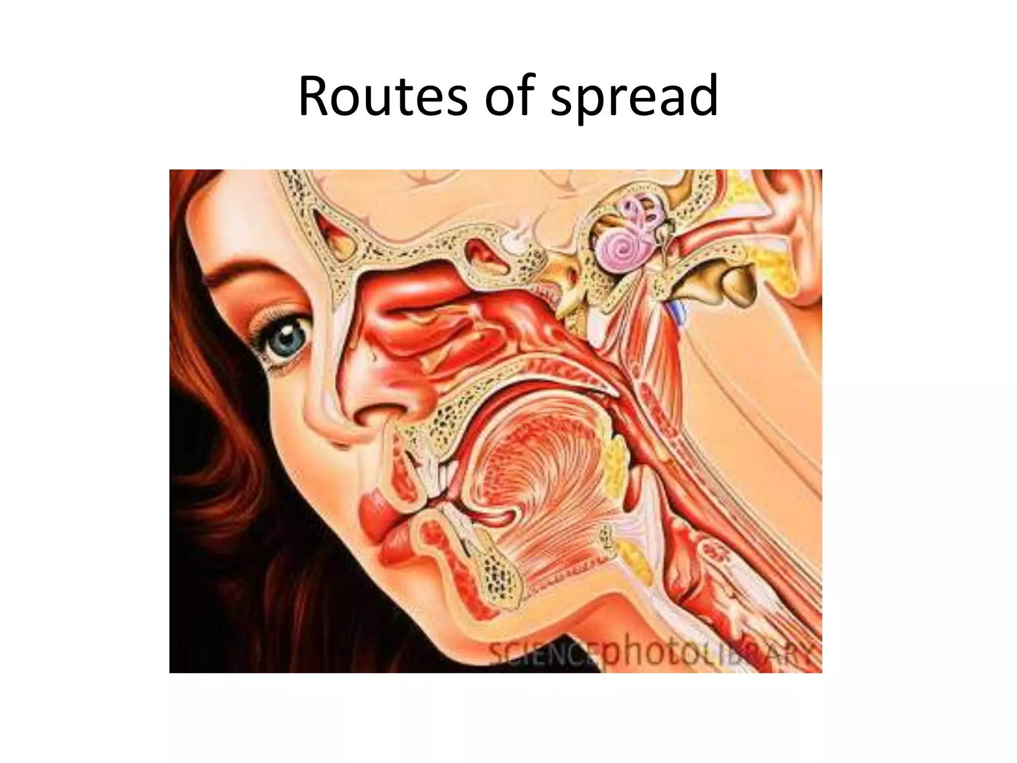 Routes of spread
 