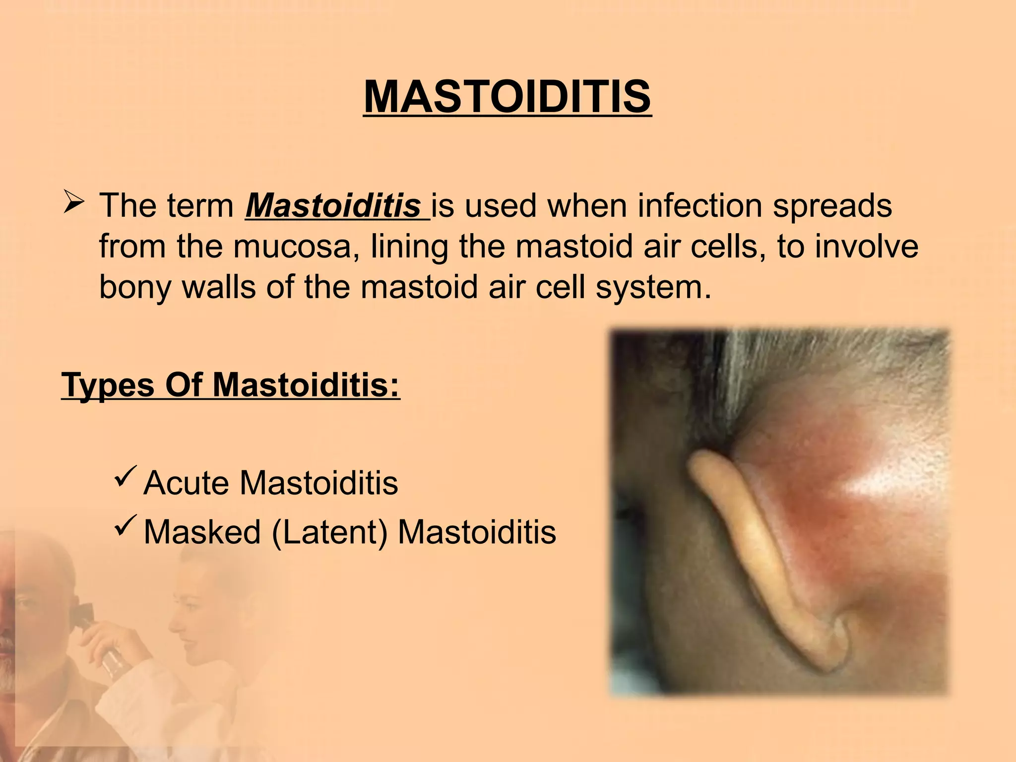 MASTOIDITIS

 The term Mastoiditis is used when infection spreads
  from the mucosa, lining the mastoid air cells, to involve
  bony walls of the mastoid air cell system.

Types Of Mastoiditis:

    Acute Mastoiditis
    Masked (Latent) Mastoiditis
 