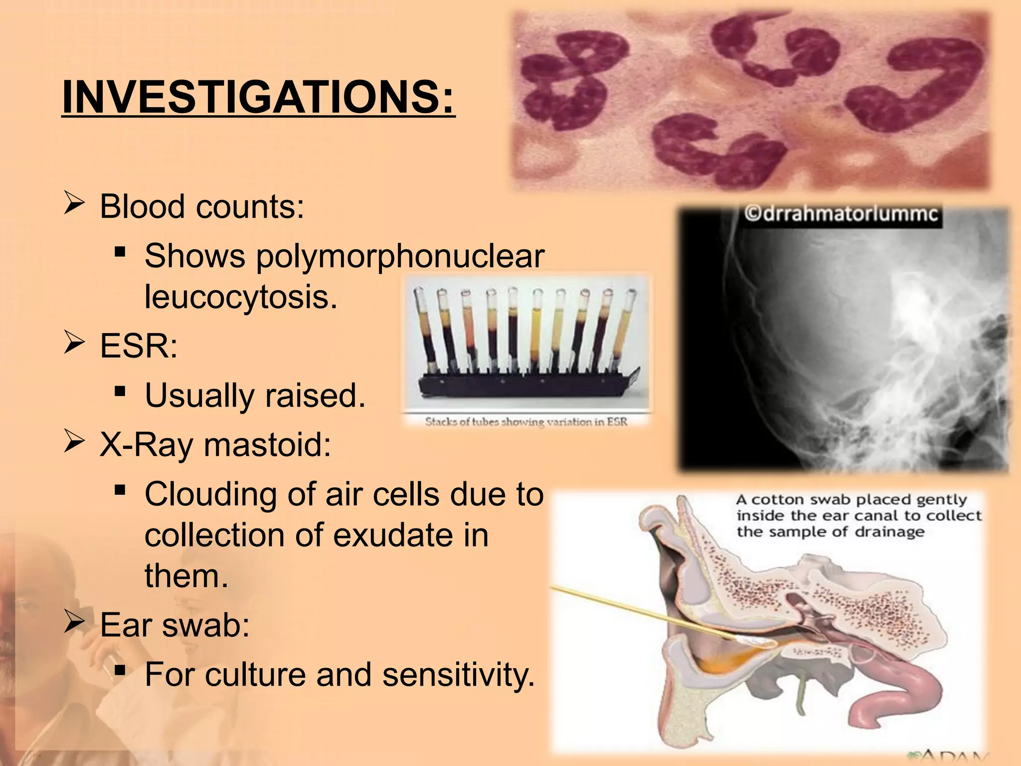 INVESTIGATIONS:

 Blood counts:
    Shows polymorphonuclear
     leucocytosis.
 ESR:
    Usually raised.
 X-Ray mastoid:
    Clouding of air cells due to
     collection of exudate in
     them.
 Ear swab:
    For culture and sensitivity.
 