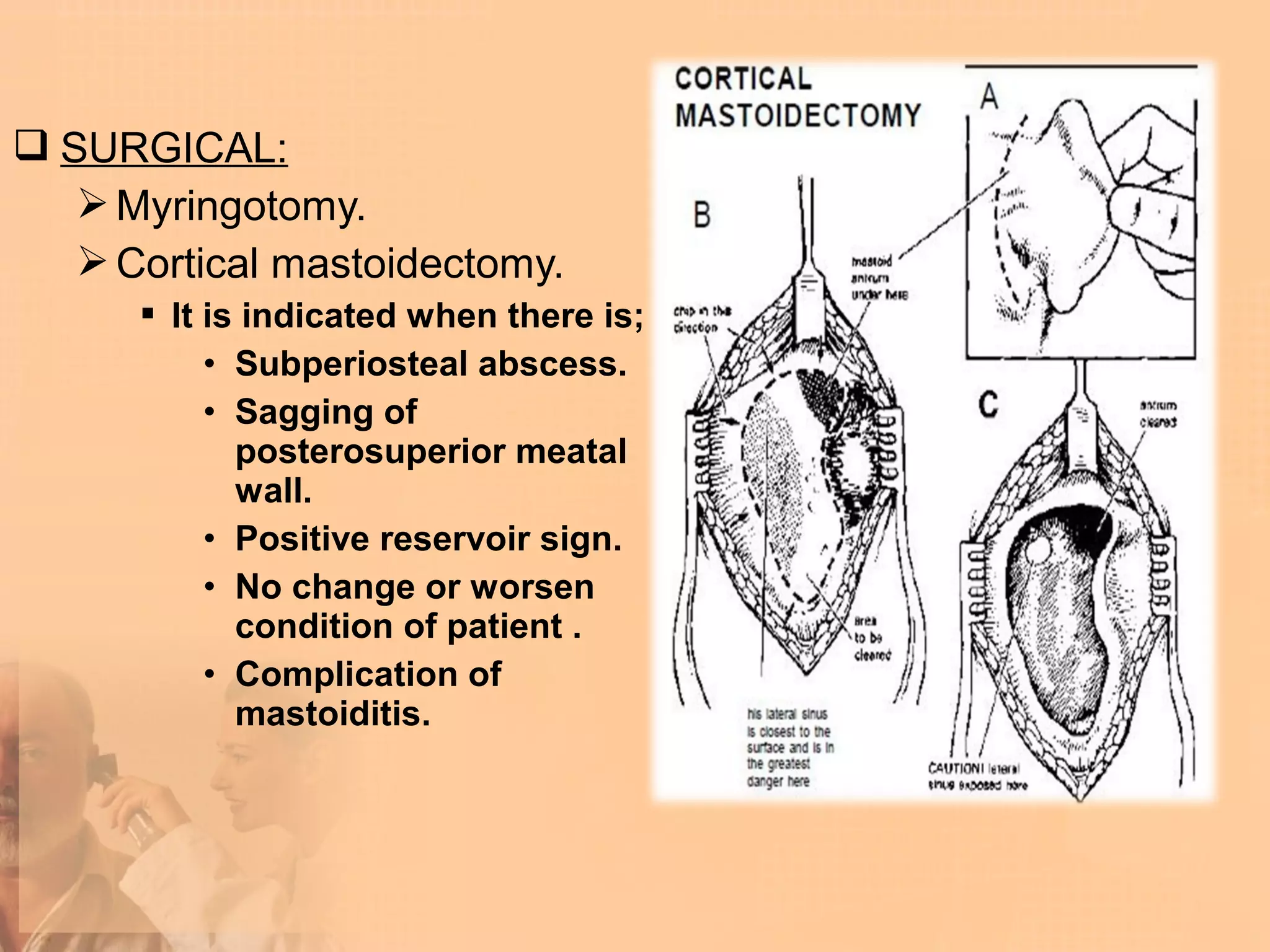  SURGICAL:
    Myringotomy.
    Cortical mastoidectomy.
       It is indicated when there is;
           • Subperiosteal abscess.
           • Sagging of
             posterosuperior meatal
             wall.
           • Positive reservoir sign.
           • No change or worsen
             condition of patient .
           • Complication of
             mastoiditis.
 