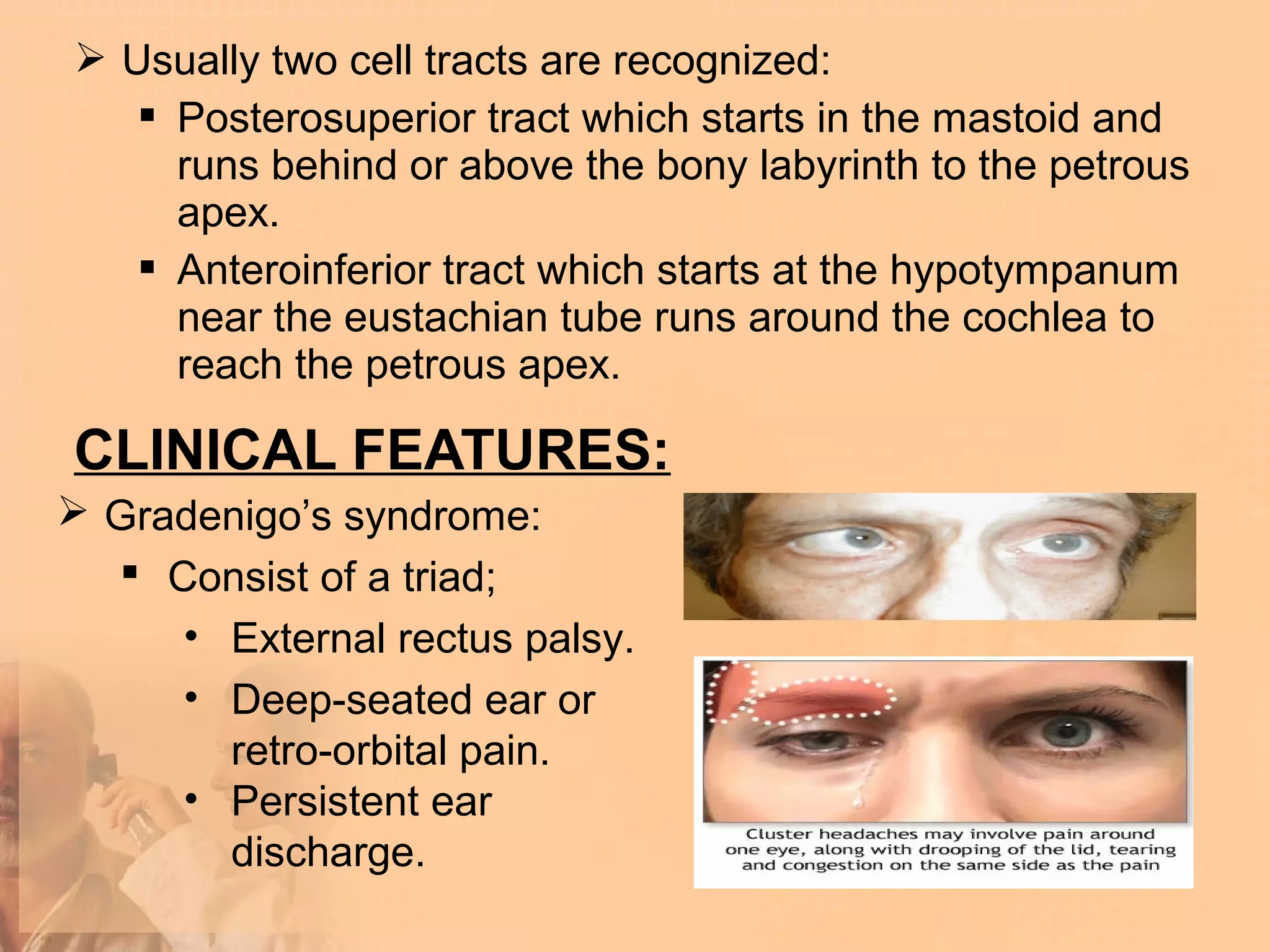  Usually two cell tracts are recognized:
    Posterosuperior tract which starts in the mastoid and
     runs behind or above the bony labyrinth to the petrous
     apex.
    Anteroinferior tract which starts at the hypotympanum
     near the eustachian tube runs around the cochlea to
     reach the petrous apex.

CLINICAL FEATURES:
 Gradenigo’s syndrome:
   Consist of a triad;
     • External rectus palsy.
     • Deep-seated ear or
       retro-orbital pain.
     • Persistent ear
       discharge.
 