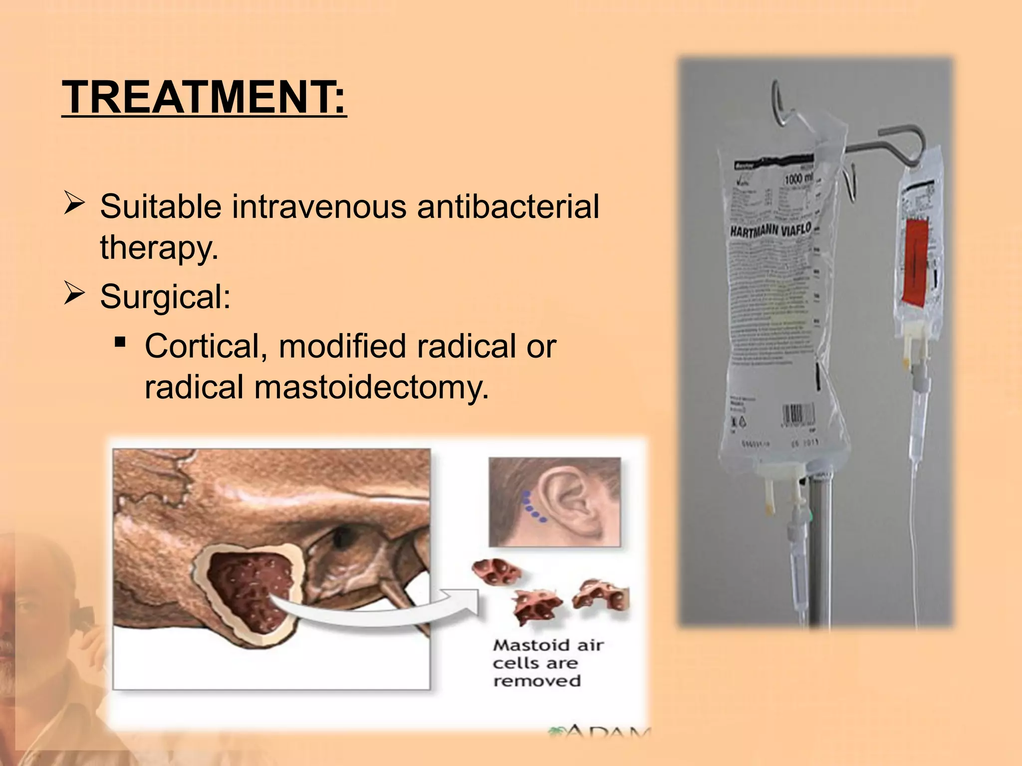 TREATMENT:

 Suitable intravenous antibacterial
  therapy.
 Surgical:
    Cortical, modified radical or
     radical mastoidectomy.
 