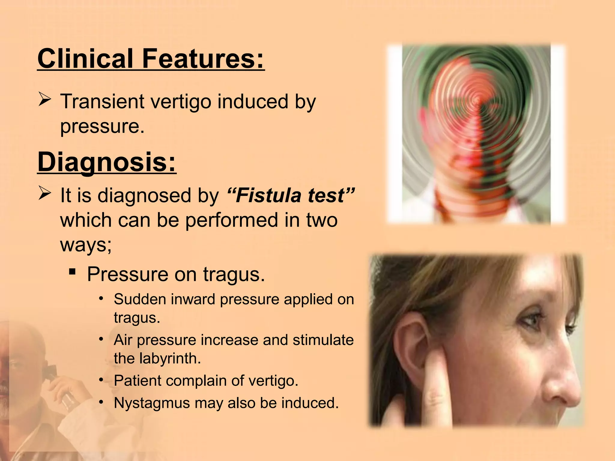 Clinical Features:
 Transient vertigo induced by
  pressure.
Diagnosis:
 It is diagnosed by “Fistula test”
  which can be performed in two
  ways;
    Pressure on tragus.
      • Sudden inward pressure applied on
        tragus.
      • Air pressure increase and stimulate
        the labyrinth.
      • Patient complain of vertigo.
      • Nystagmus may also be induced.
 