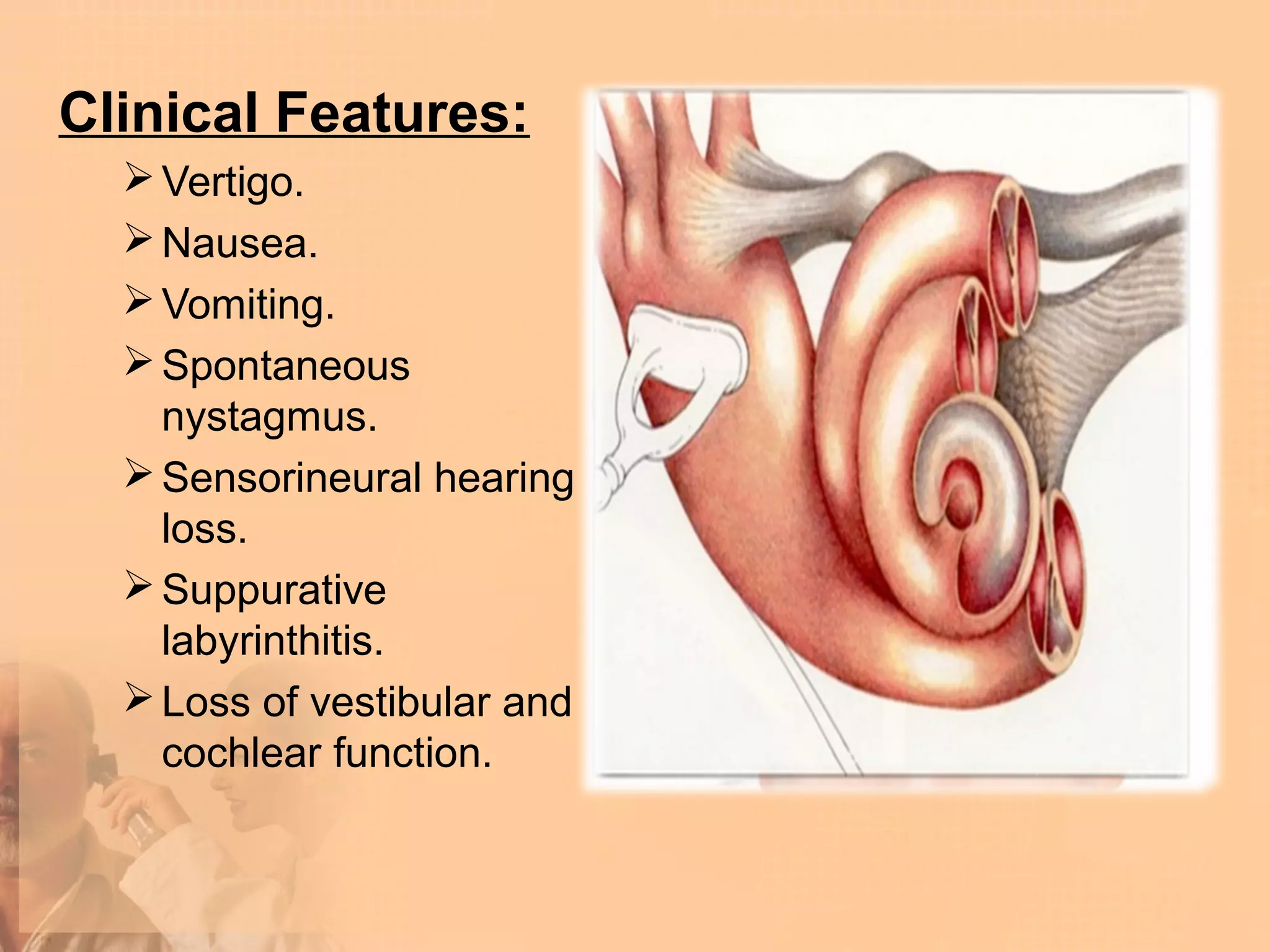 Clinical Features:
   Vertigo.
   Nausea.
   Vomiting.
   Spontaneous
    nystagmus.
   Sensorineural hearing
    loss.
   Suppurative
    labyrinthitis.
   Loss of vestibular and
    cochlear function.
 