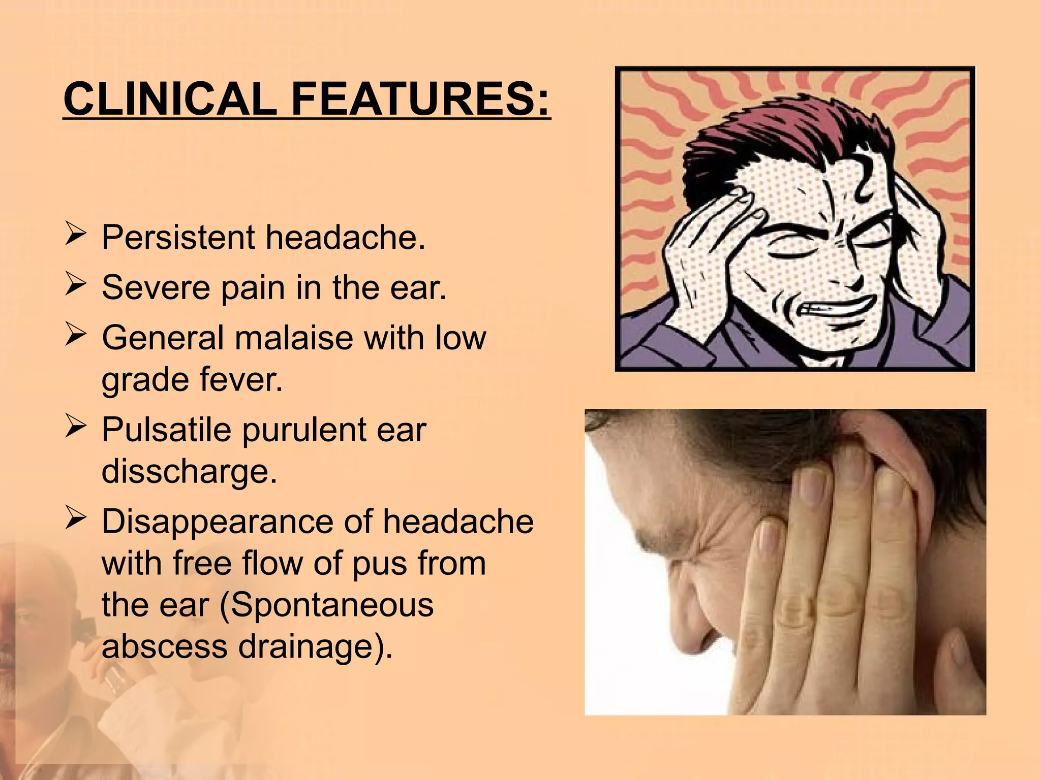 CLINICAL FEATURES:

 Persistent headache.
 Severe pain in the ear.
 General malaise with low
  grade fever.
 Pulsatile purulent ear
  disscharge.
 Disappearance of headache
  with free flow of pus from
  the ear (Spontaneous
  abscess drainage).
 
