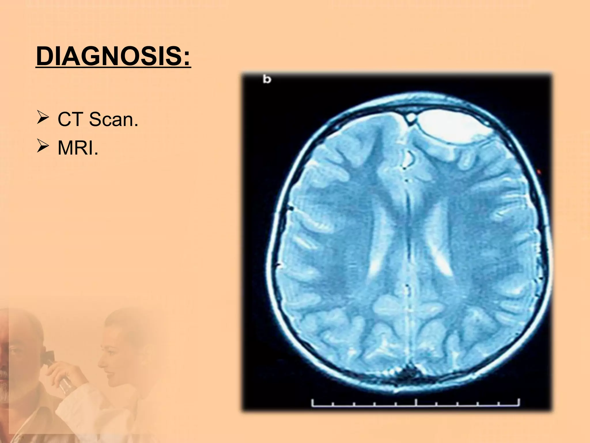 DIAGNOSIS:

 CT Scan.
 MRI.
 