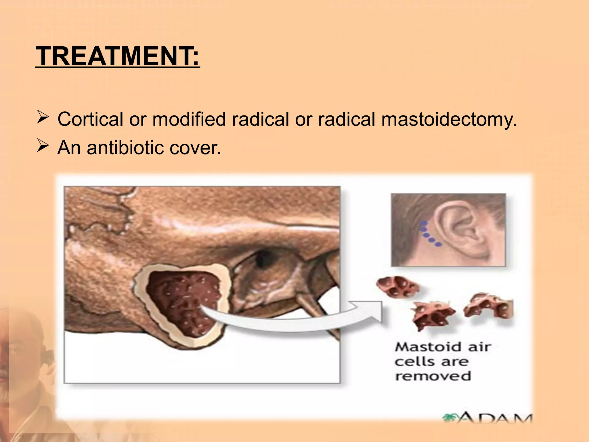 TREATMENT:

 Cortical or modified radical or radical mastoidectomy.
 An antibiotic cover.
 