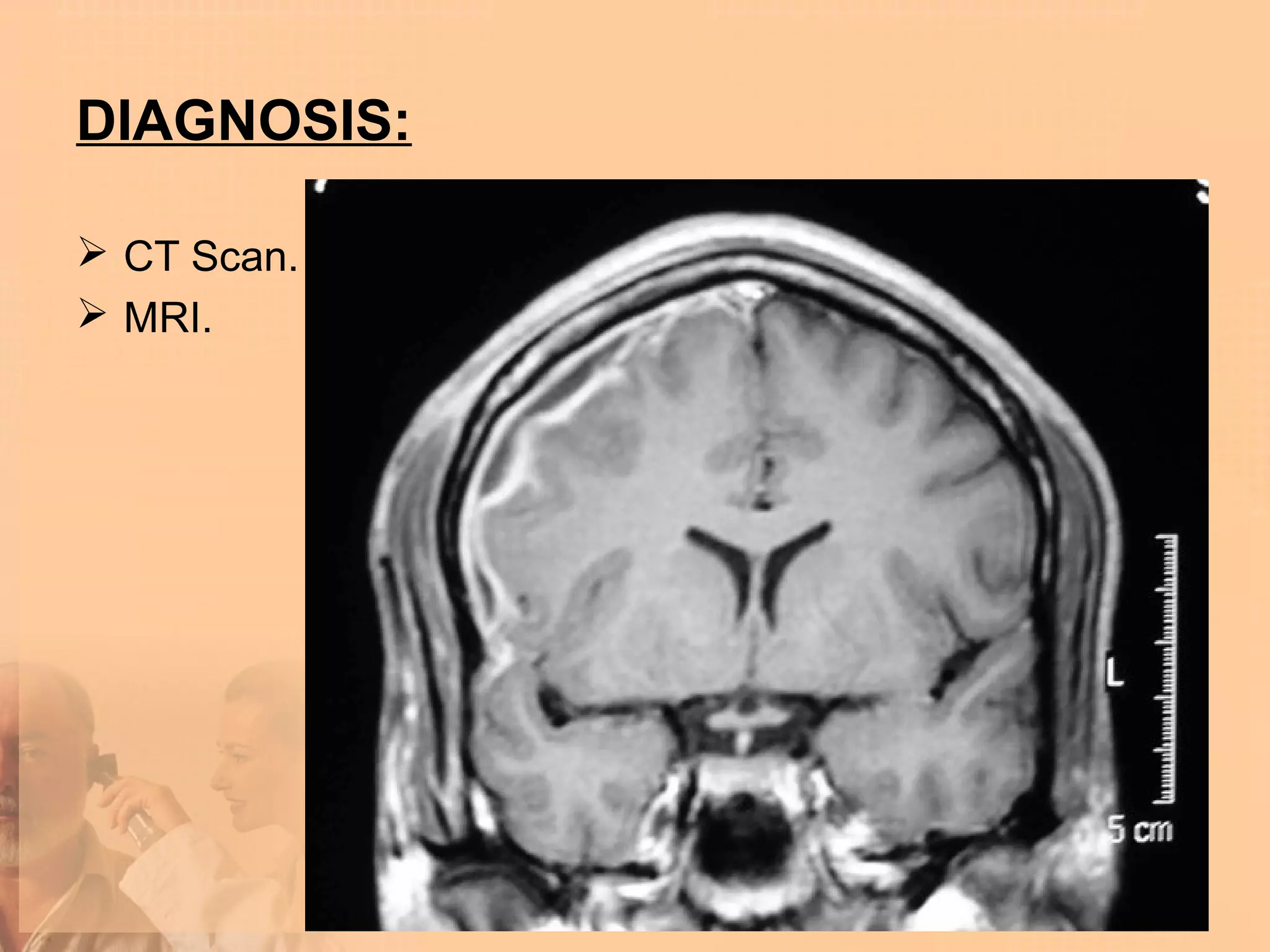 DIAGNOSIS:

 CT Scan.
 MRI.
 
