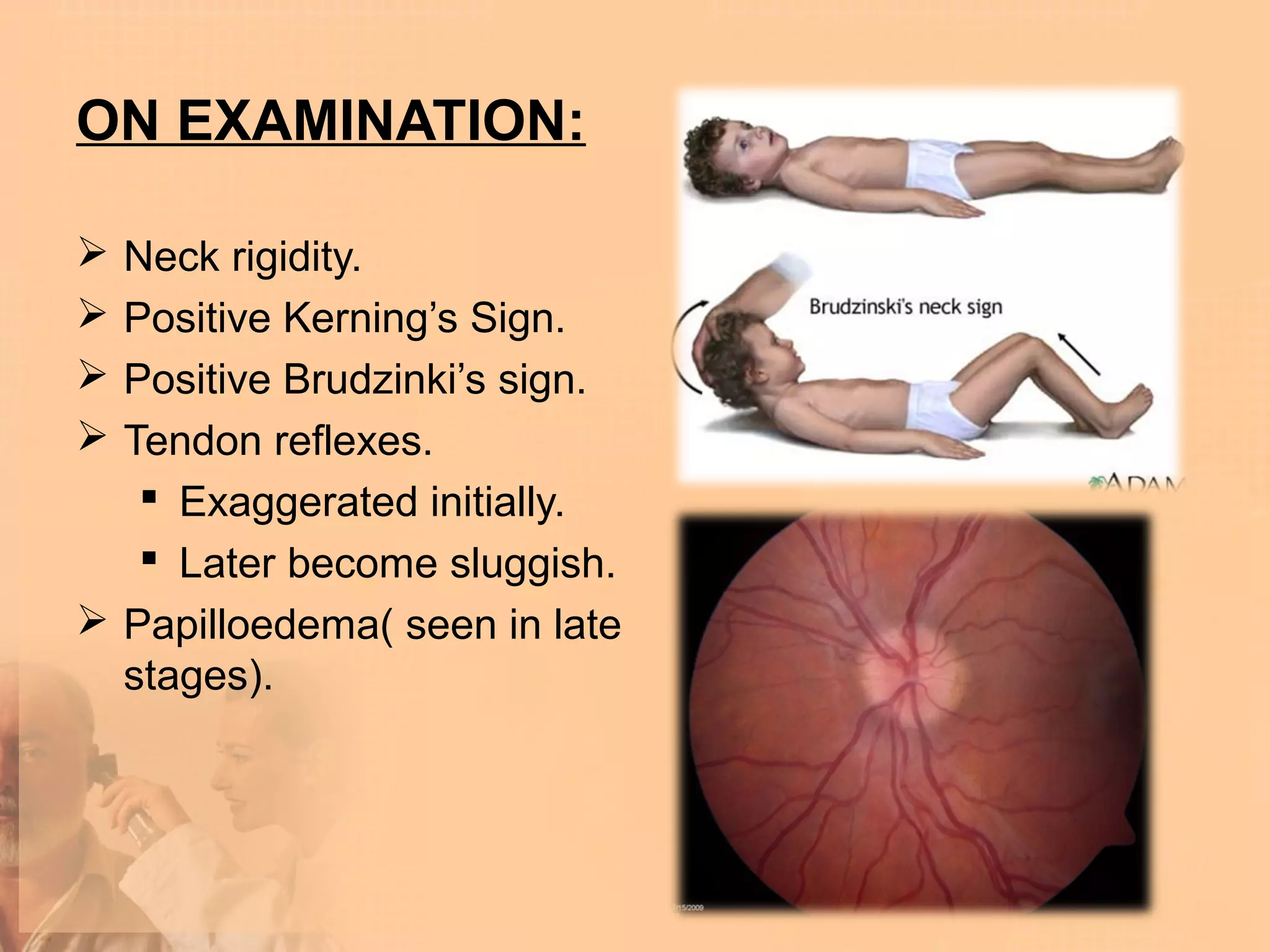 ON EXAMINATION:

 Neck rigidity.
 Positive Kerning’s Sign.
 Positive Brudzinki’s sign.
 Tendon reflexes.
    Exaggerated initially.
    Later become sluggish.
 Papilloedema( seen in late
  stages).
 