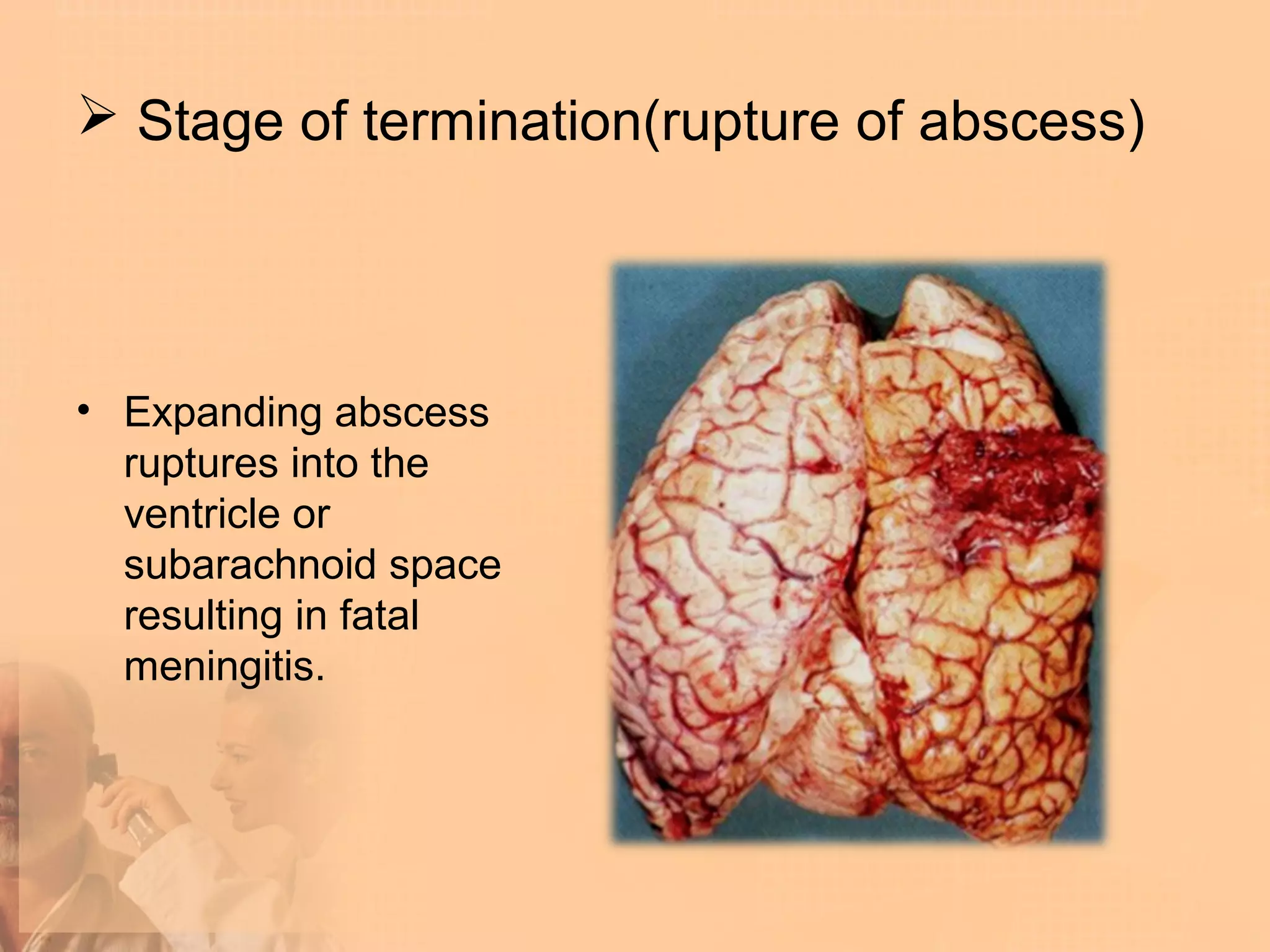  Stage of termination(rupture of abscess)




• Expanding abscess
  ruptures into the
  ventricle or
  subarachnoid space
  resulting in fatal
  meningitis.
 
