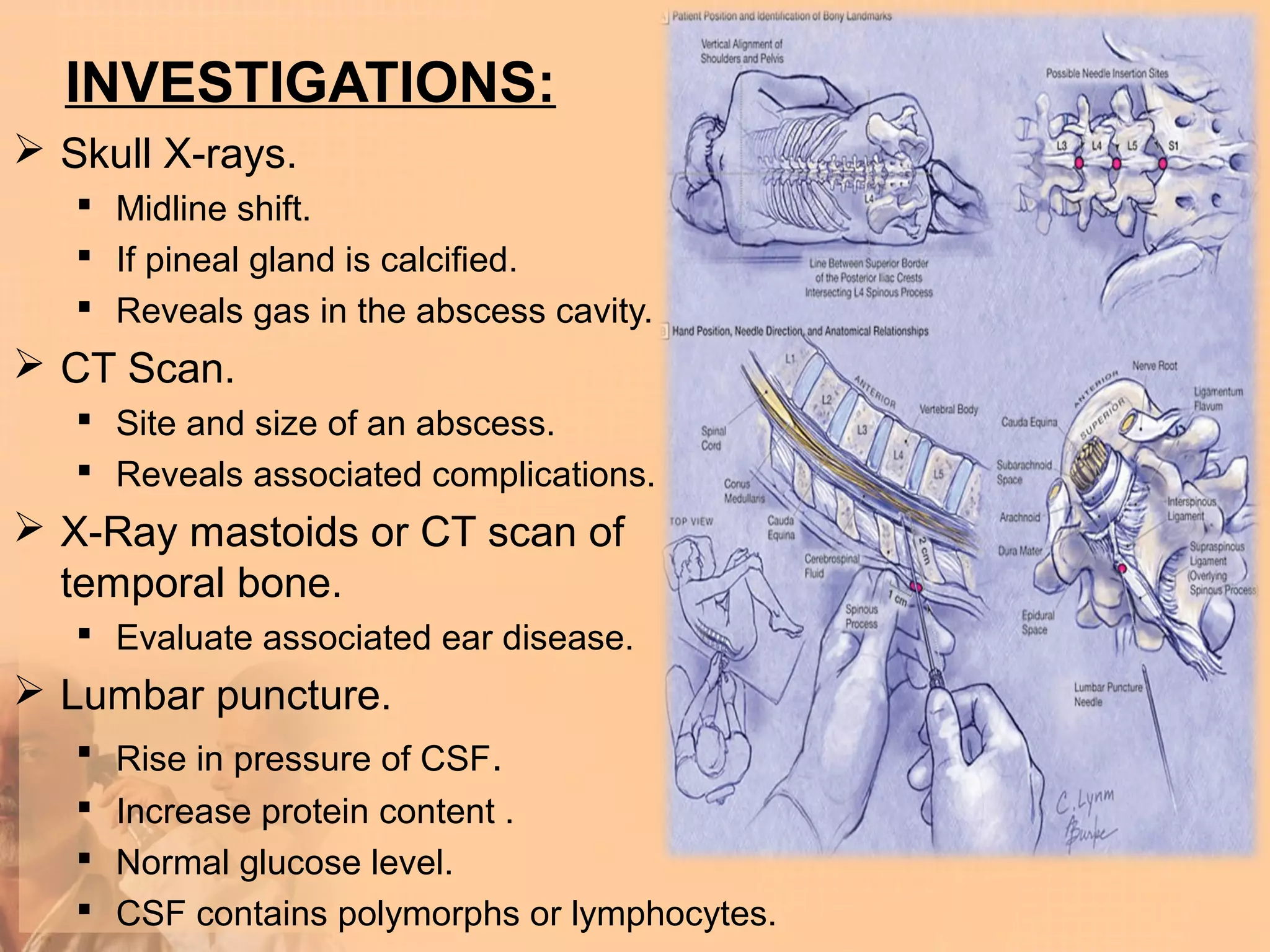 INVESTIGATIONS:
 Skull X-rays.
    Midline shift.
    If pineal gland is calcified.
    Reveals gas in the abscess cavity.
 CT Scan.
    Site and size of an abscess.
    Reveals associated complications.
 X-Ray mastoids or CT scan of
  temporal bone.
    Evaluate associated ear disease.
 Lumbar puncture.
    Rise in pressure of CSF.
    Increase protein content .
    Normal glucose level.
    CSF contains polymorphs or lymphocytes.
 