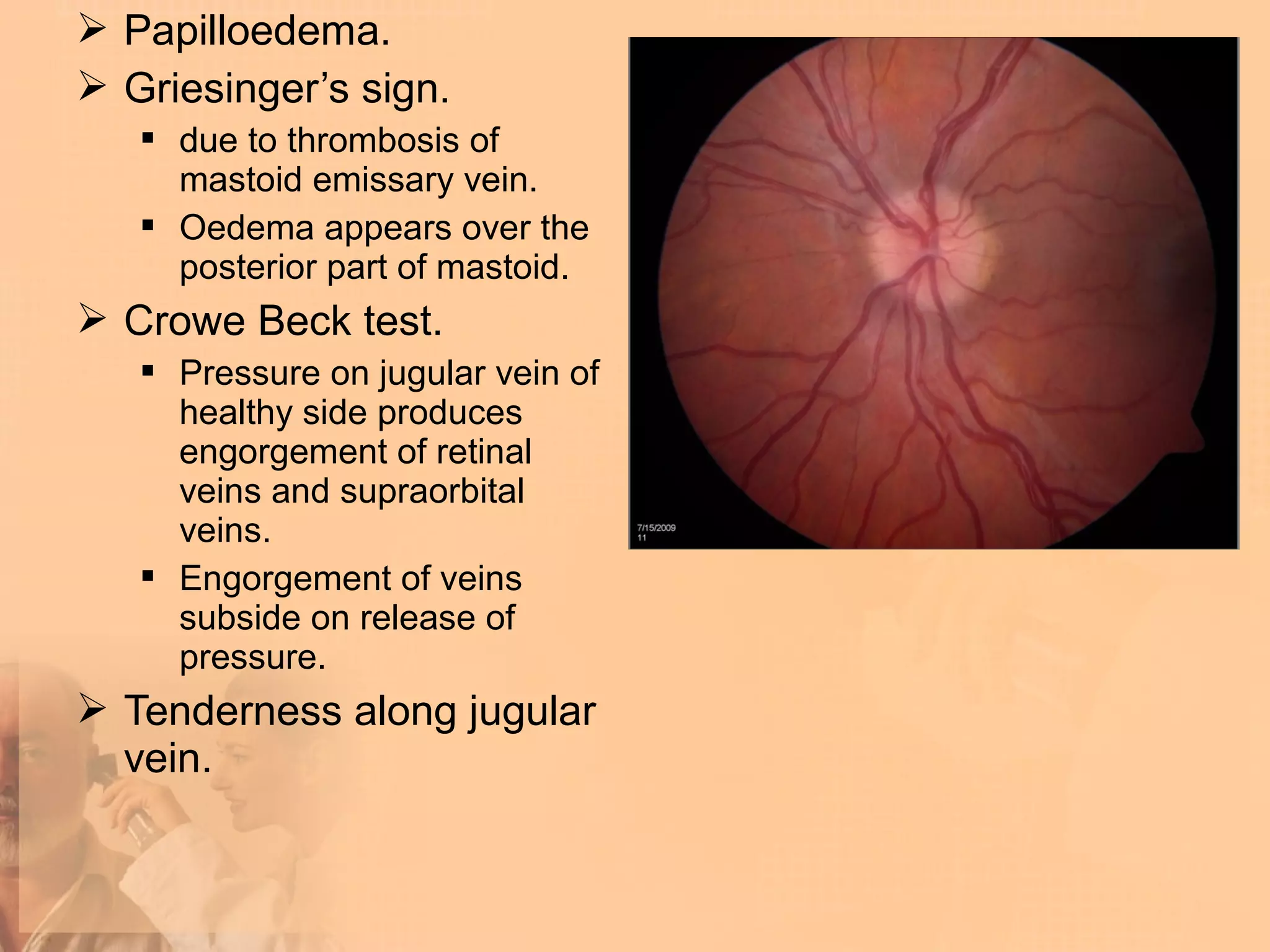  Papilloedema.
 Griesinger’s sign.
    due to thrombosis of
     mastoid emissary vein.
    Oedema appears over the
     posterior part of mastoid.
 Crowe Beck test.
    Pressure on jugular vein of
     healthy side produces
     engorgement of retinal
     veins and supraorbital
     veins.
    Engorgement of veins
     subside on release of
     pressure.
 Tenderness along jugular
  vein.
 
