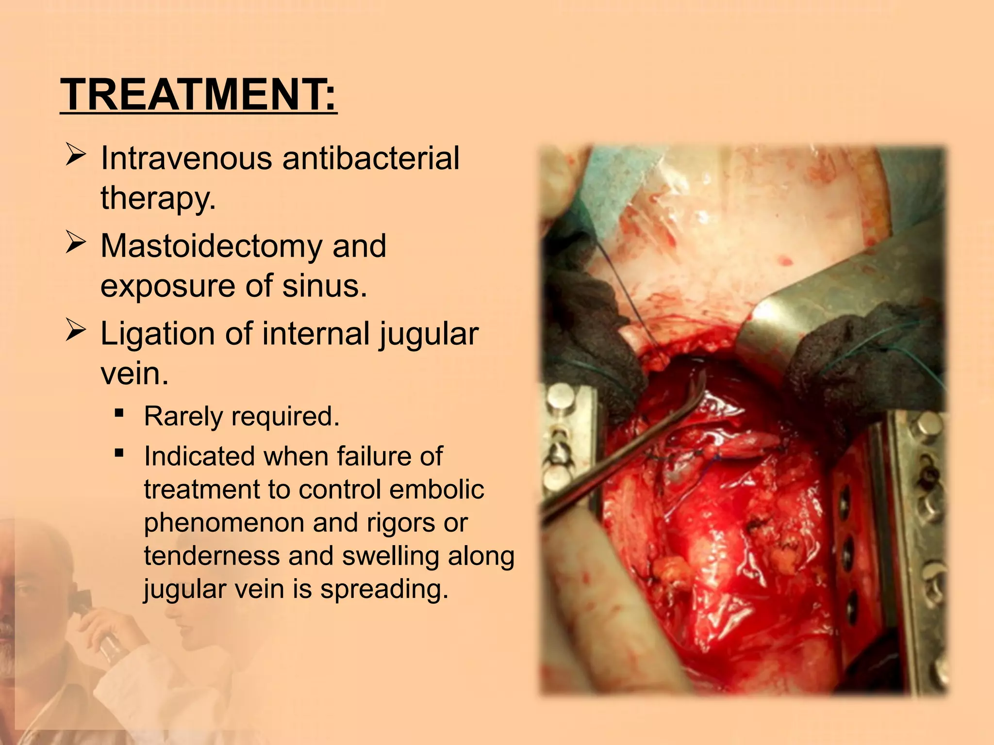 TREATMENT:
 Intravenous antibacterial
  therapy.
 Mastoidectomy and
  exposure of sinus.
 Ligation of internal jugular
  vein.
    Rarely required.
    Indicated when failure of
     treatment to control embolic
     phenomenon and rigors or
     tenderness and swelling along
     jugular vein is spreading.
 