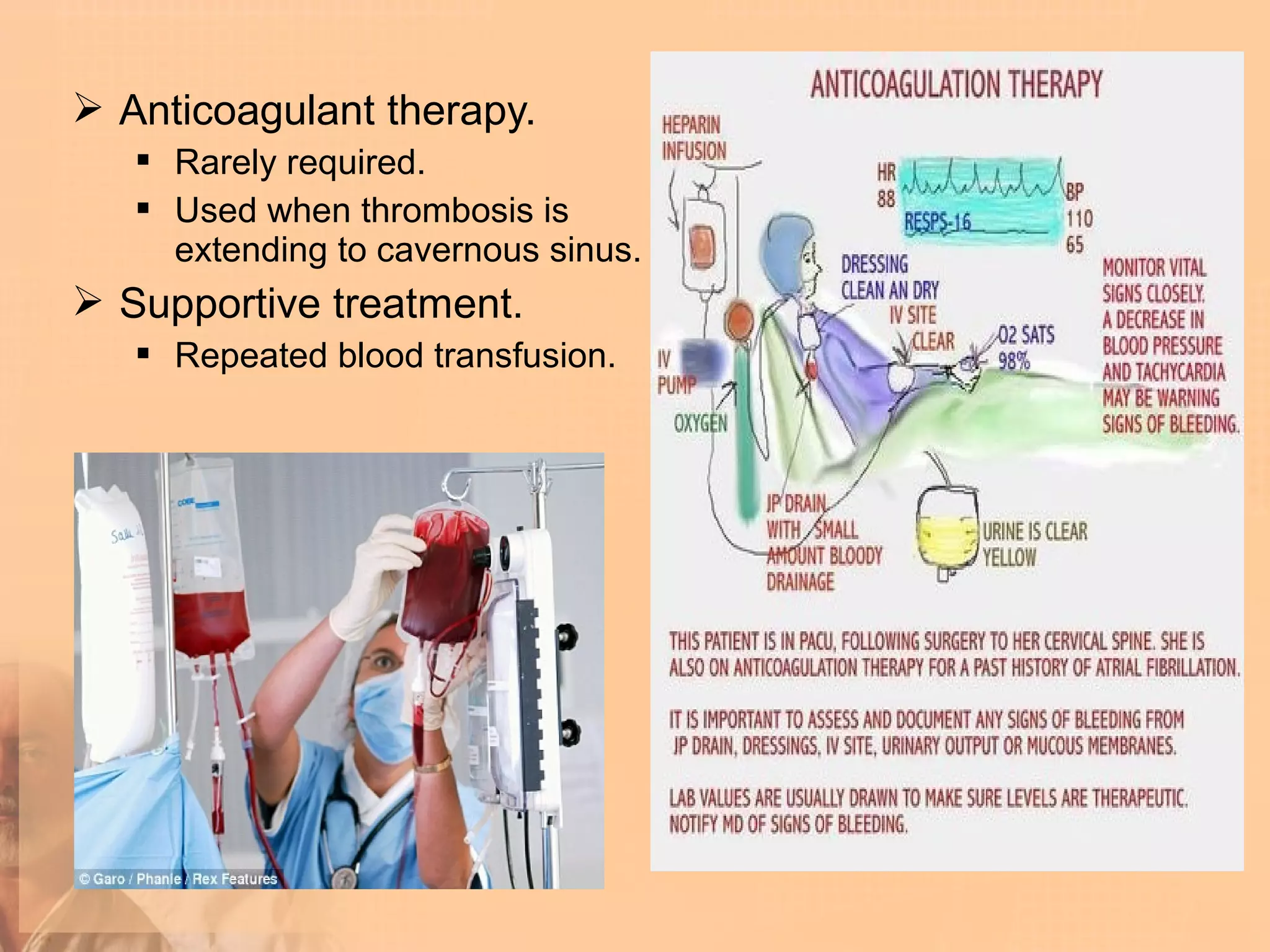  Anticoagulant therapy.
    Rarely required.
    Used when thrombosis is
     extending to cavernous sinus.
 Supportive treatment.
    Repeated blood transfusion.
 