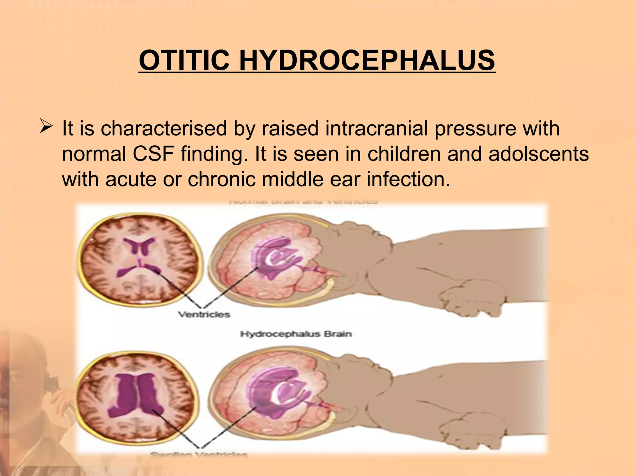 OTITIC HYDROCEPHALUS

 It is characterised by raised intracranial pressure with
  normal CSF finding. It is seen in children and adolscents
  with acute or chronic middle ear infection.
 