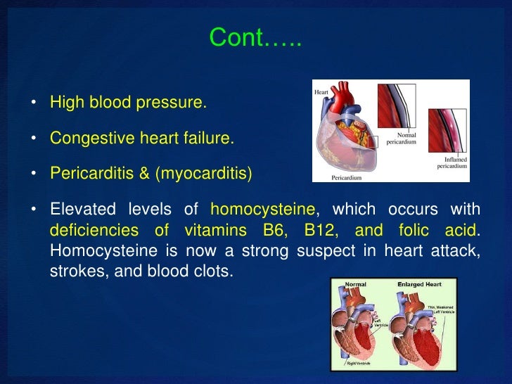 Complications of systemic lupus erythematosus