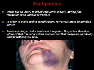  Occur due to injury to blood capillaries mainly during flap
retraction with various retractors.
 In order to avoid such a complication, retractors must be handled
gently.
 Treatment: No particular treatment is required. The patient should be
informed that it is not a serious situation and that ecchymoses gradually
subside within a few days.
 