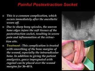  This is a common complication, which
occurs immediately after the anesthetic
wears off.
 Due to sharp bony spicules, the uneven
bone edges injure the soft tissues of the
postextraction socket, resulting in severe
pain and inflammation at the extrac-
tion site.
 Treatment : This complication is treated
with smoothing of the bone margins of
the wound, especially the intraradicular
bone. In addition to giving the patient
analgesics, gauze impregnated with
eugenol can be placed over the wound
margins for 36–48 h.
 