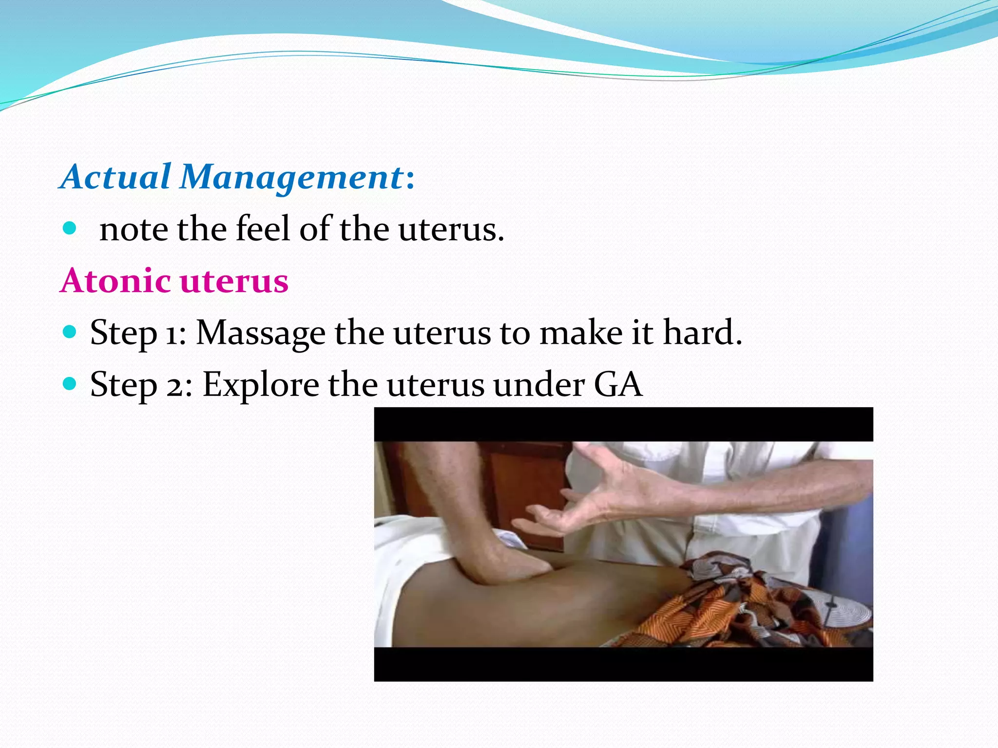 Actual Management:
 note the feel of the uterus.
Atonic uterus
 Step 1: Massage the uterus to make it hard.
 Step 2: Explore the uterus under GA
 