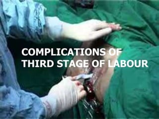 COMPLICATIONS OF
THIRD STAGE OF LABOUR
 