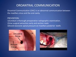 OROANTRAL COMMUNICATION
Oroantral Communication (OAC) is an abnormal communication between
the maxillary sinus and the ora...
