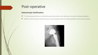 Post-operative
Heterotropic Ossification:
 IT is the abnormal growth of bones in non skeletal tissues such as joints, tendons or other soft tissues at an increased rate resulting in painful joints.
 Risk factors include male patient, traumatic brain injury, Traumatic amputation, patients with ankylosing spondylitis, and joint replacement surgeries.
 