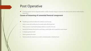 Post Operative
 At each post operative visit the radiographs shouldbe carefully evaluated for changes in components, the cement if present, the bone and the interfaces
between them.
Causes of loosening of cemented femoral component
 The following are technical problems that contribute to stem loosening
1. Failure to remove soft cancellous bone from medial surface of the femoral neck
2. Failure to provide a cement mantle of adequate thickness around the entire stem
3. Removal of all trabecular bone from the canal, leaving a smooth surface with no capacity for cement intrusion
4. In adequate quantity of cement
5. Failure to pressurize the cement
6. Failure to position the component in a neutral or centralized position in the femoral canal.
 