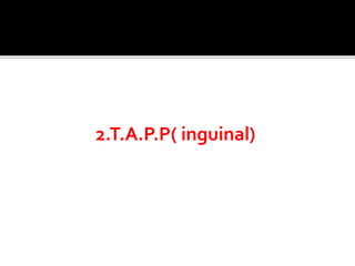 2.T.A.P.P( inguinal)
 