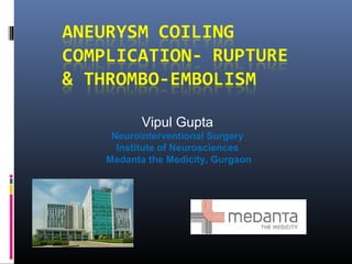 Vipul Gupta
Neurointerventional Surgery
Institute of Neurosciences
Medanta the Medicity, Gurgaon
 