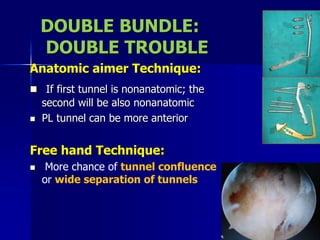 Anatomic aimer Technique:
 If first tunnel is nonanatomic; the
second will be also nonanatomic
 PL tunnel can be more anterior
Free hand Technique:
 More chance of tunnel confluence
or wide separation of tunnels
DOUBLE BUNDLE:
DOUBLE TROUBLE
 