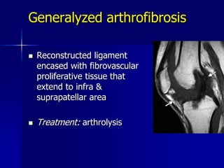 Generalyzed arthrofibrosis
 Reconstructed ligament
encased with fibrovascular
proliferative tissue that
extend to infra &
suprapatellar area
 Treatment: arthrolysis
 