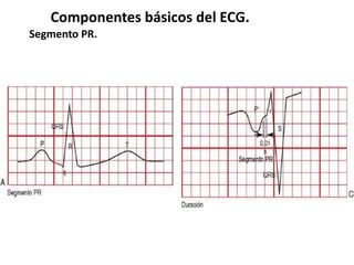 Componentes básicos del ECG.
Segmento PR.
 