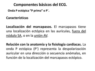 Características
Localización del marcapasos. El marcapasos tiene
una localización ectópica en las aurículas, fuera del
nódulo SA, o en la unión AV.
Relación con la anatomía y la fisiología cardíacas. La
onda P ectópica (P’) representa la despolarización
auricular en una dirección o secuencia anómalas, en
función de la localización del marcapasos ectópico.
Componentes básicos del ECG.
Onda P ectópica “P prima” o P´.
 