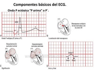 Componentes básicos del ECG.
Onda P ectópica “P prima” o P´.
 