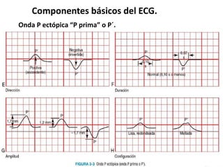 Componentes básicos del ECG.
Onda P ectópica “P prima” o P´.
 