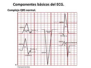 Componentes básicos del ECG.
Complejo QRS normal.
 