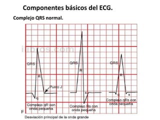 Componentes básicos del ECG.
Complejo QRS normal.
 